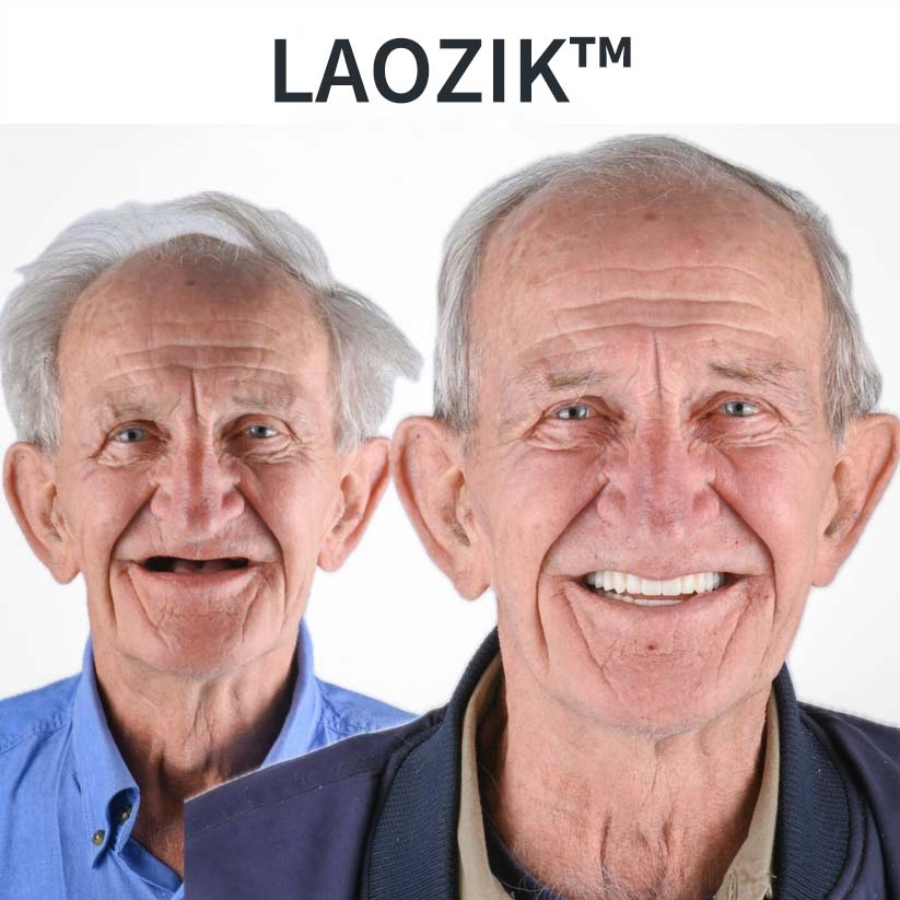 LAOZIKTM AdaptableFit Functional Dentures – Made in the USA & FDA-Certified